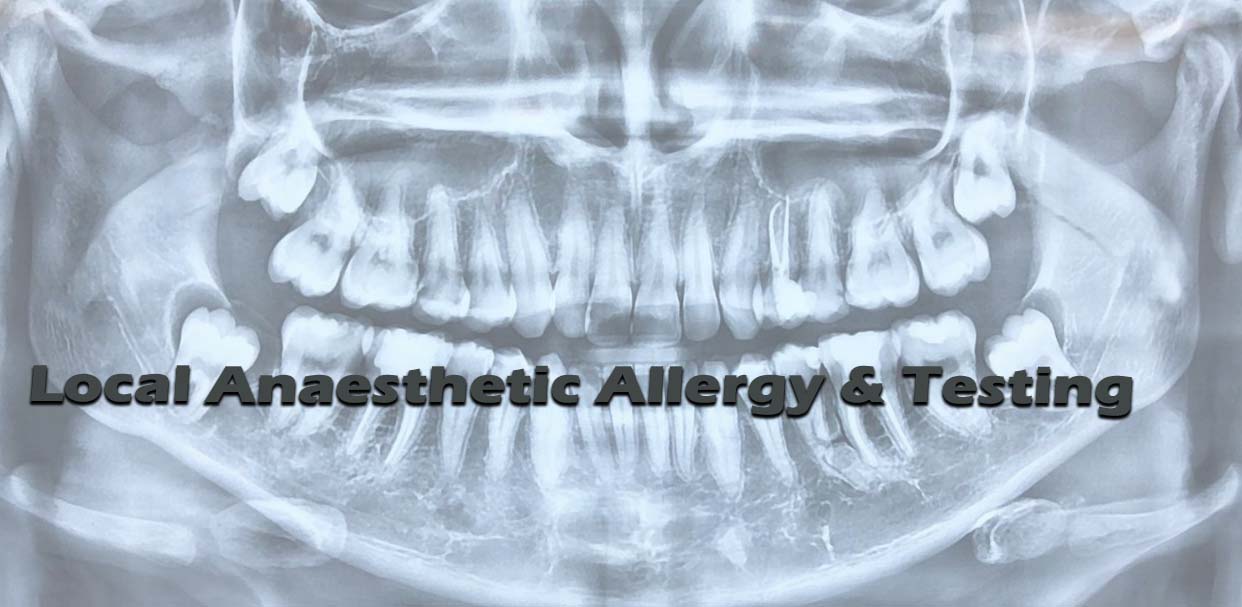 Local Anaesthetic Allergy & Testing